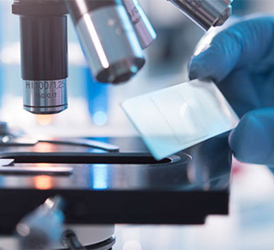 Global Live Cell Imaging Market 2019-2023